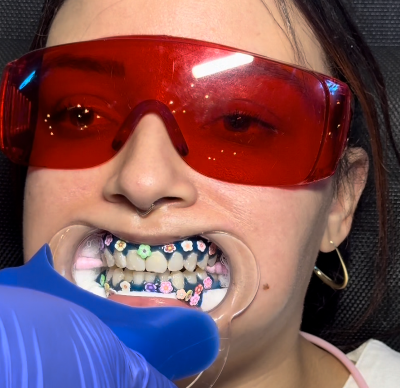 Gauze