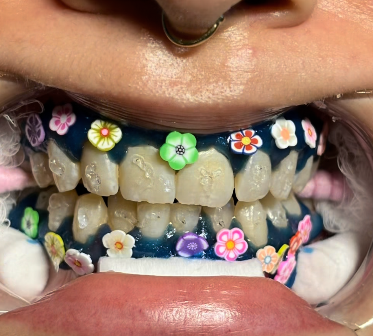 Teeth Decal