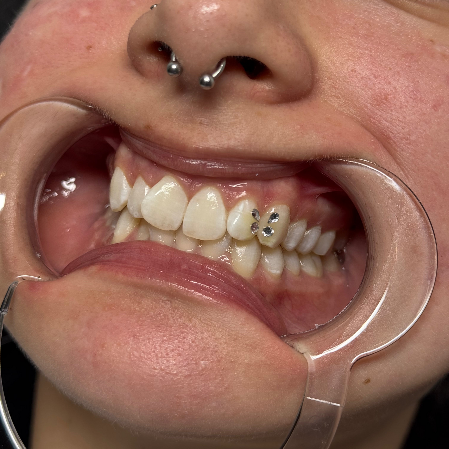 60 Minute Teeth Whitening + Custom Gems