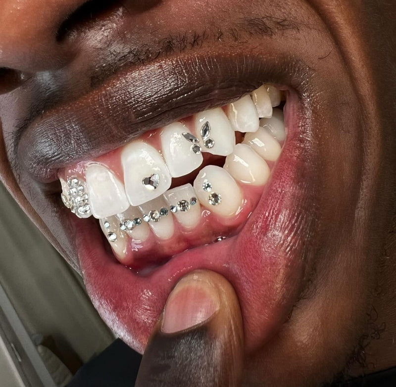 Custom Design Close-up of tooth gems applied by Grin & Glow, featuring high-quality, non-invasive crystals for a stylish, sparkling smile upgrade.