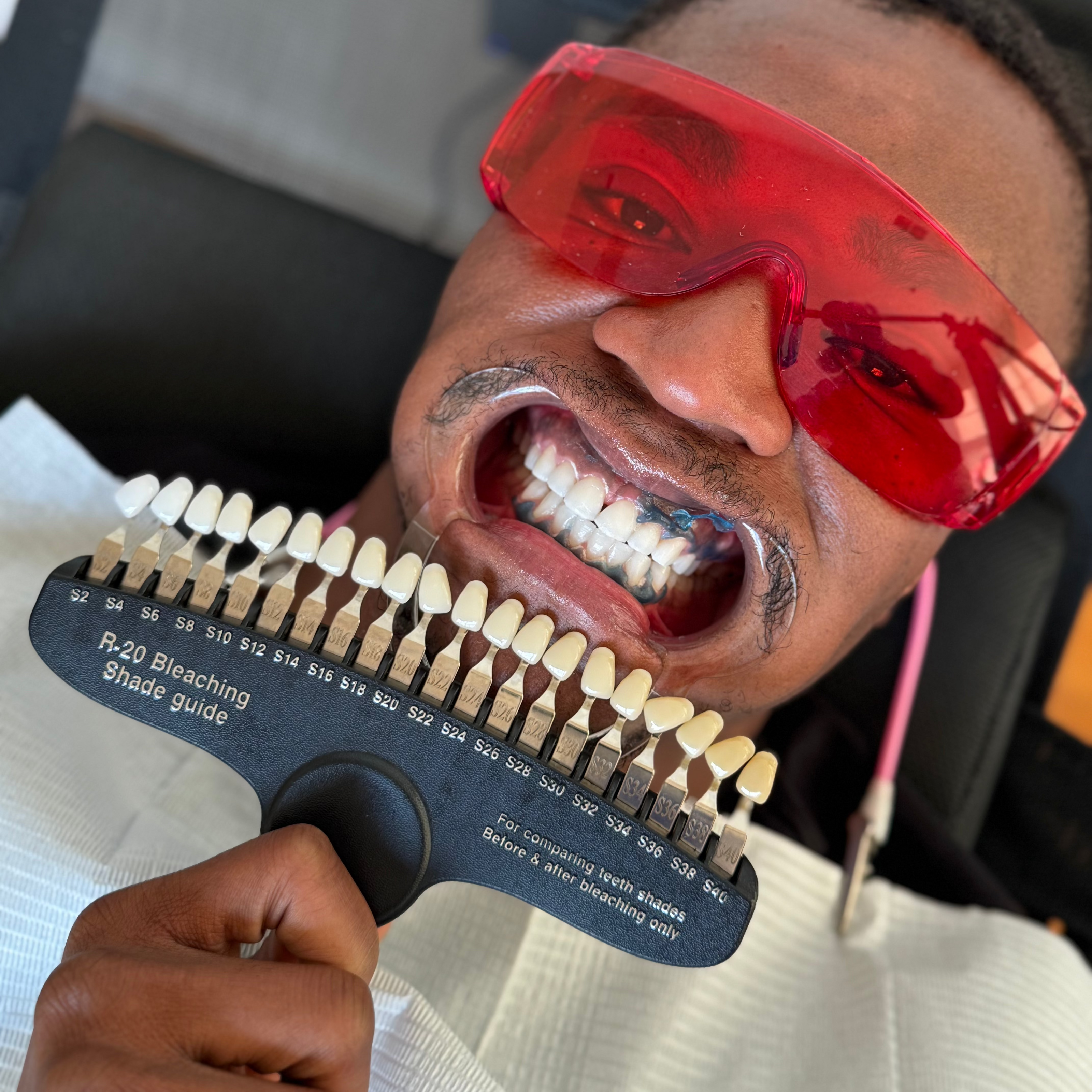 Teeth whitening treatment at Grin & Glow LLC in Rochester NY using LED light and vegan-friendly dental-grade gel for visibly whiter smiles.