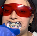 Gauze