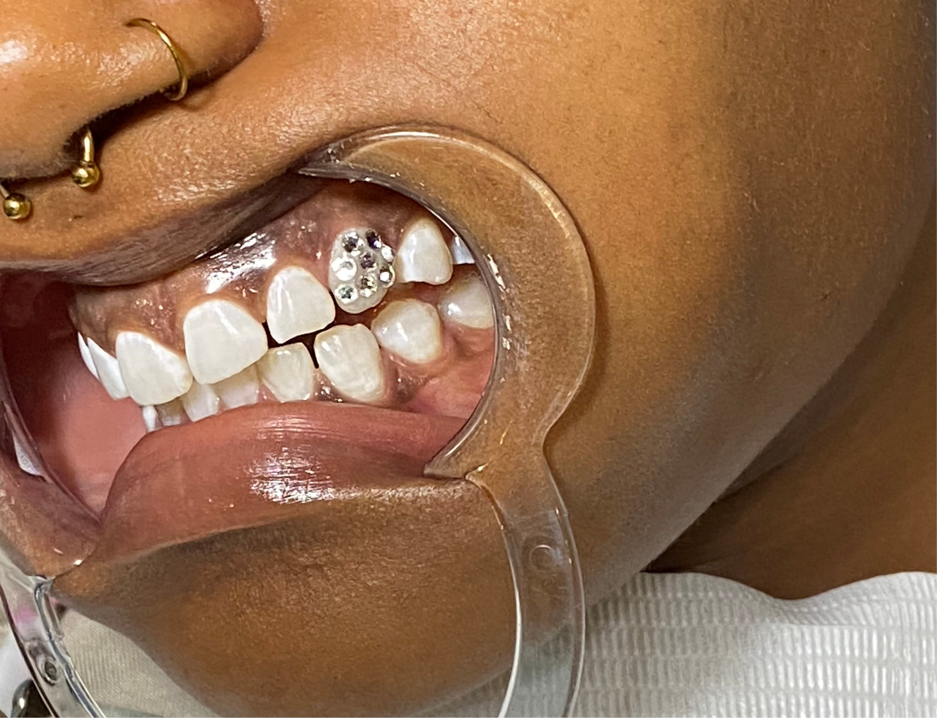 Discoball tooth gem