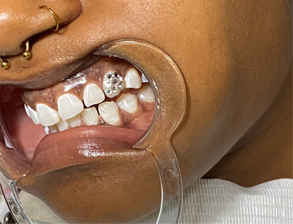 Iced Out Tooth
