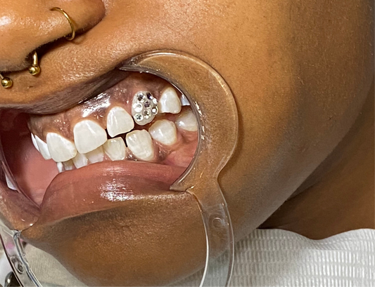 Iced Out Tooth