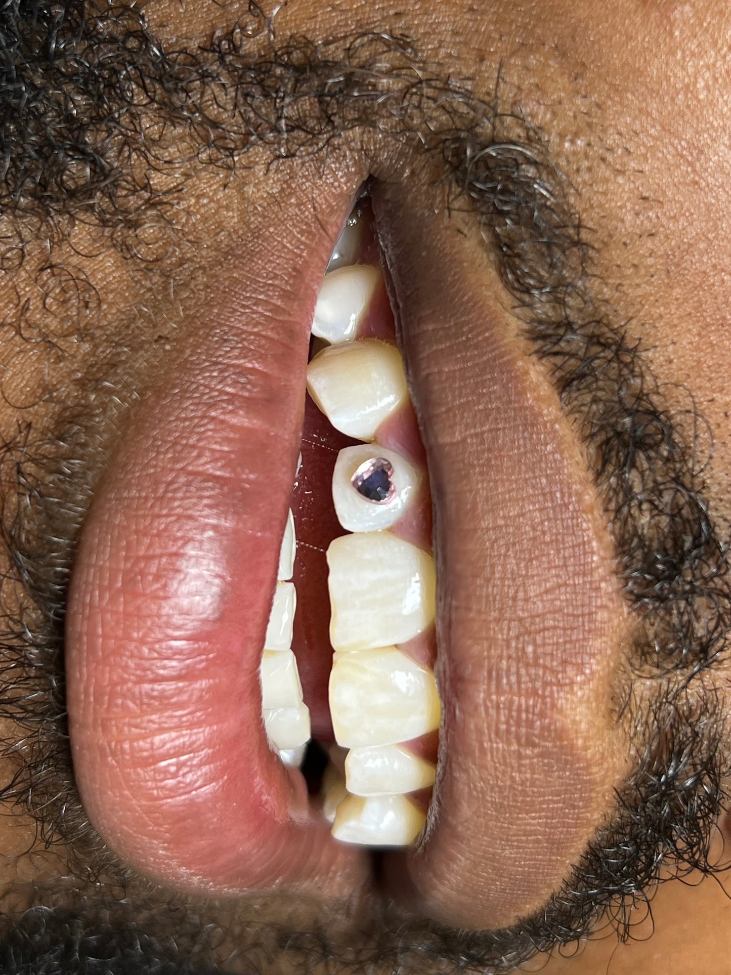 90 Minute Teeth Whitening + Custom Gems