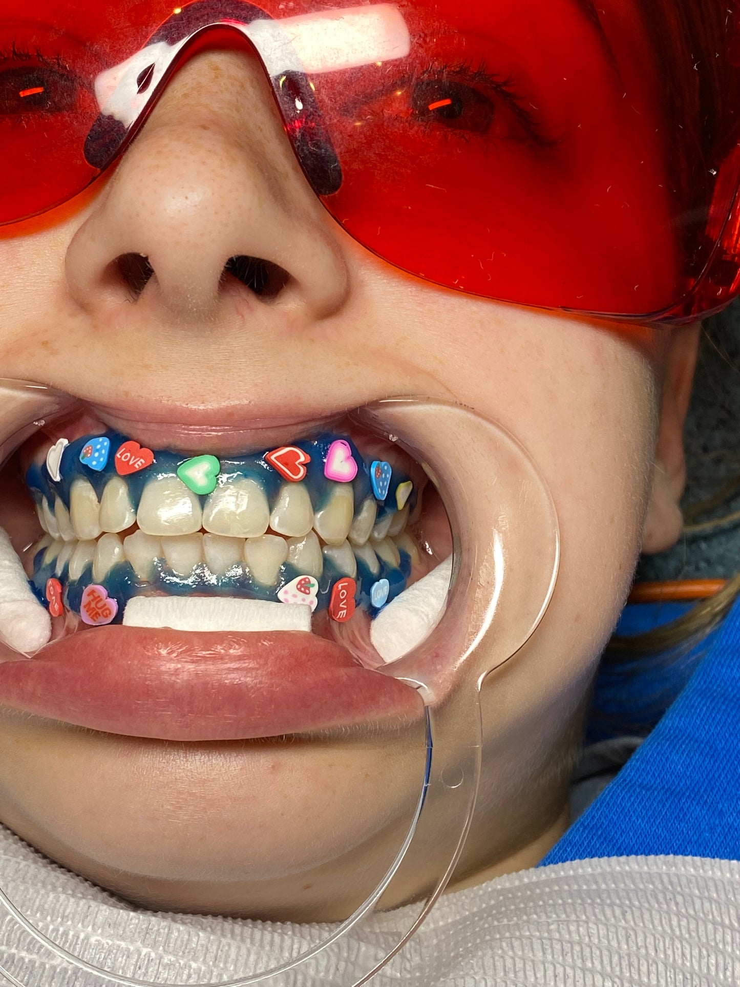 Gum Protector