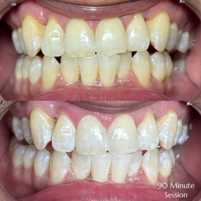 90 Minutes Top-Up (Returning Client Only)