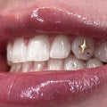 Grin & Glow tooth gem gold 