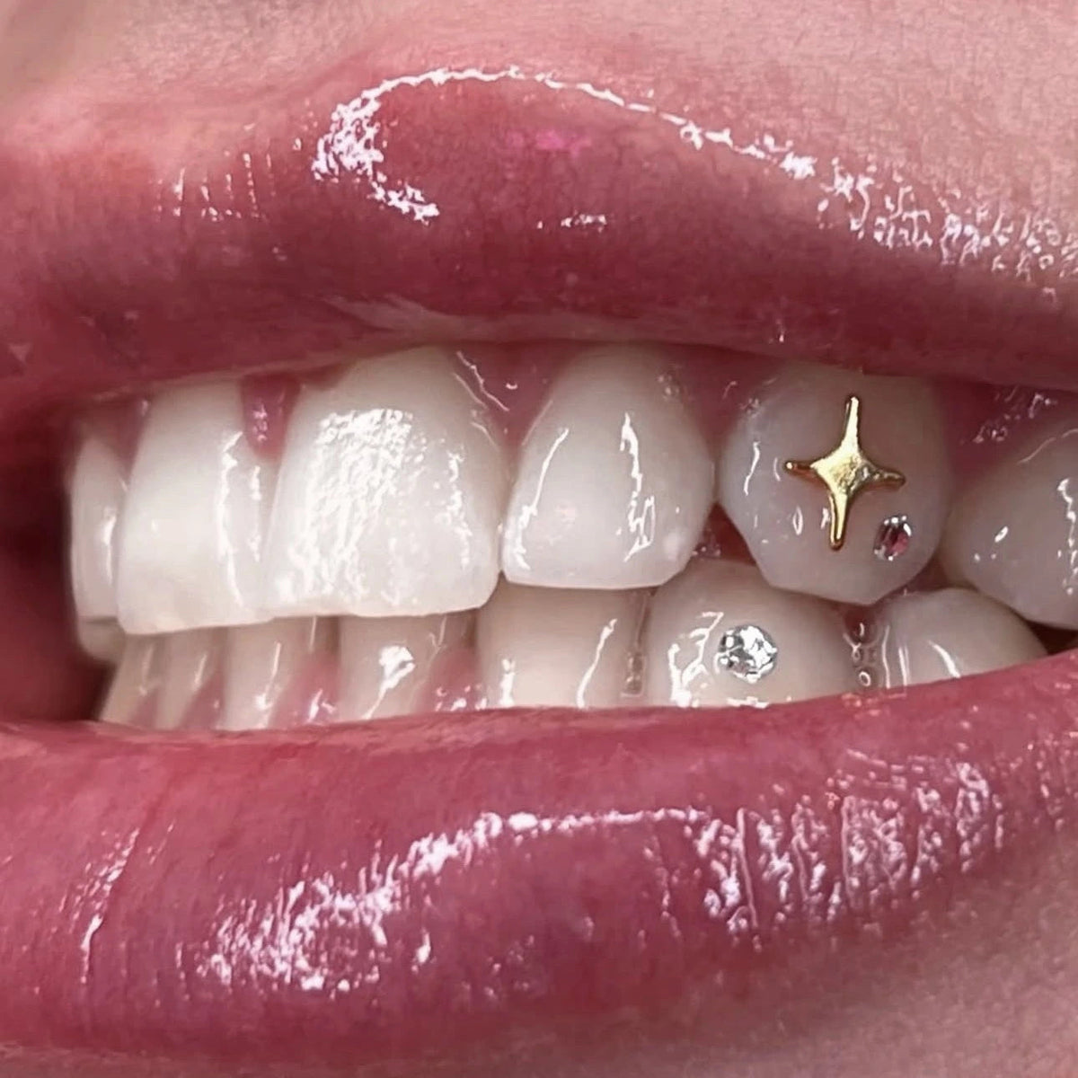 Grin & Glow tooth gem gold 