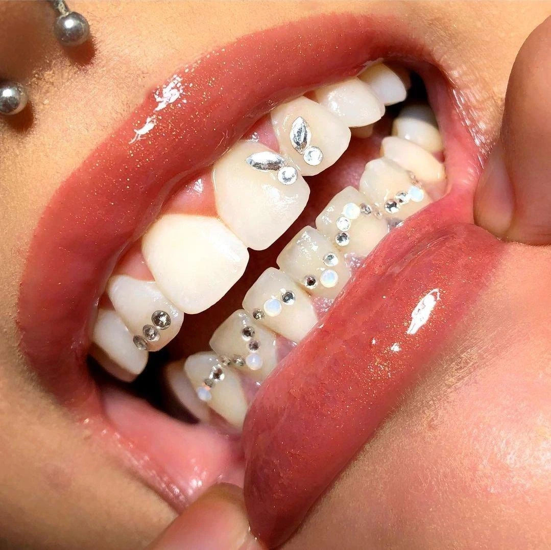 grin and glow tooth gem rochester ny