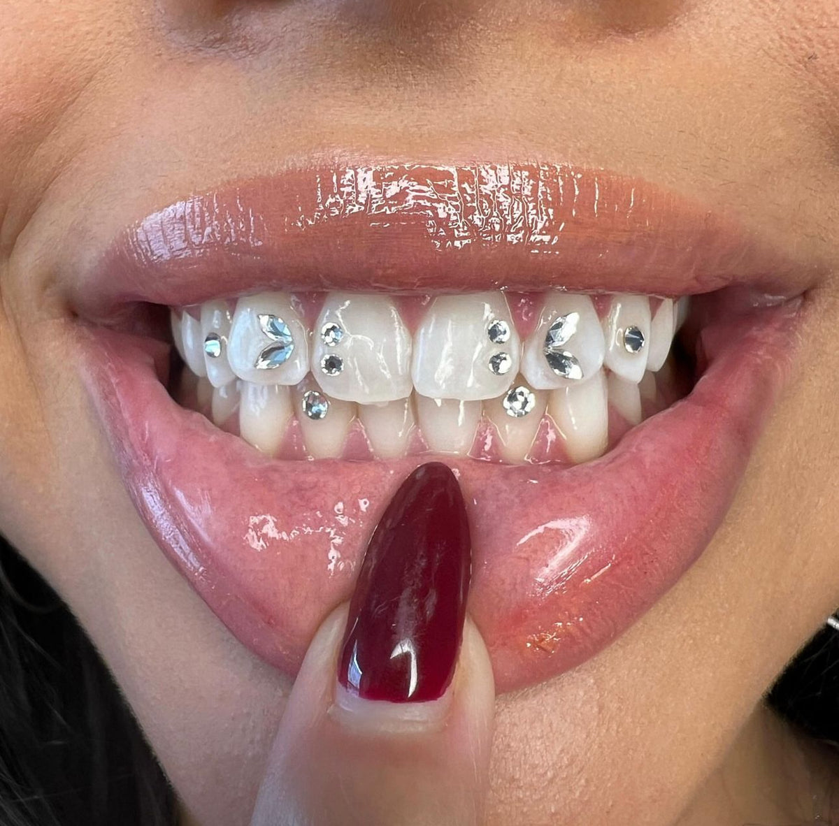 3 Gems Close-up of tooth gems applied by Grin & Glow, featuring high-quality, non-invasive crystals for a stylish, sparkling smile upgrade