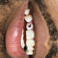 30 Minute Teeth Whitening + Custom Gems