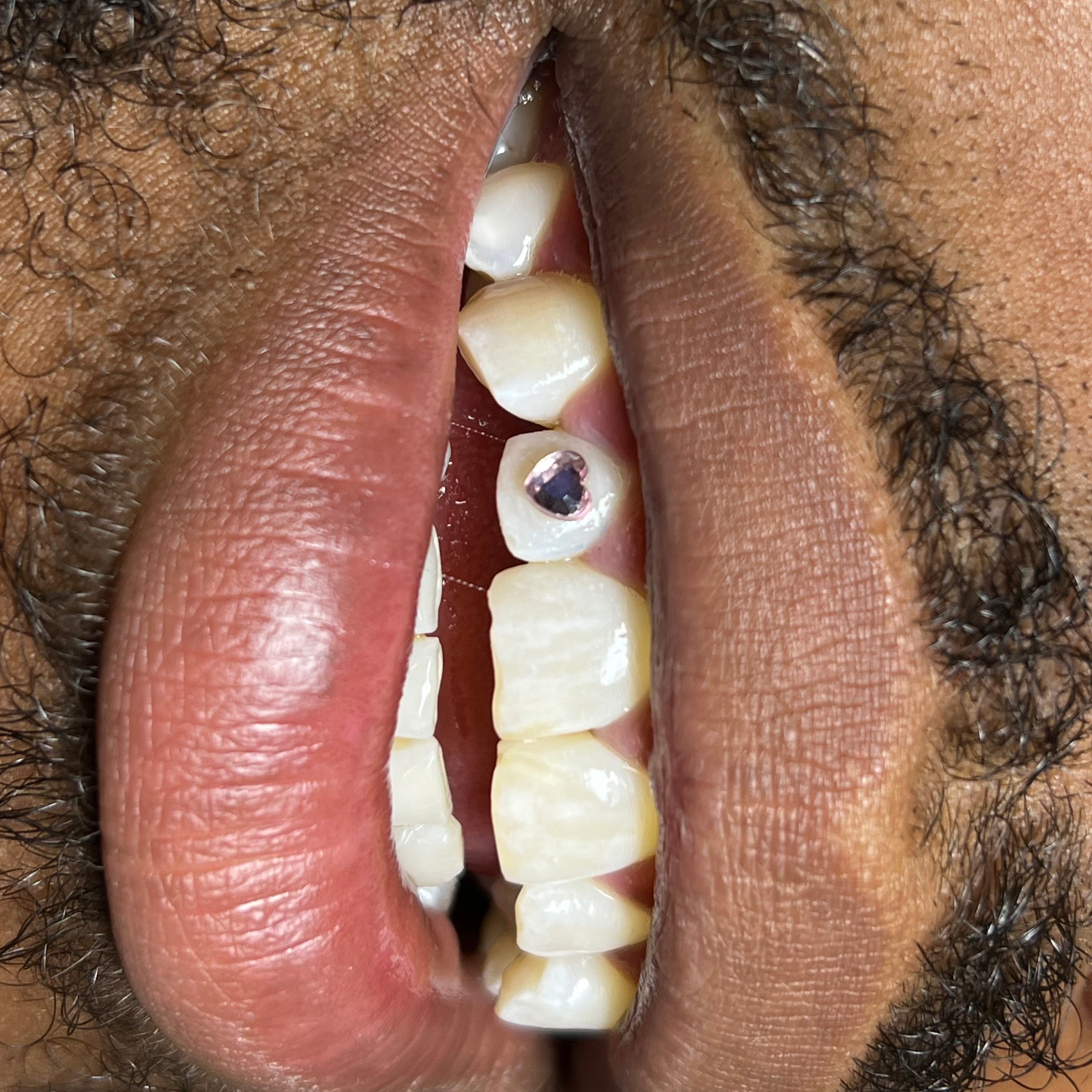 30 Minute Teeth Whitening + Custom Gems
